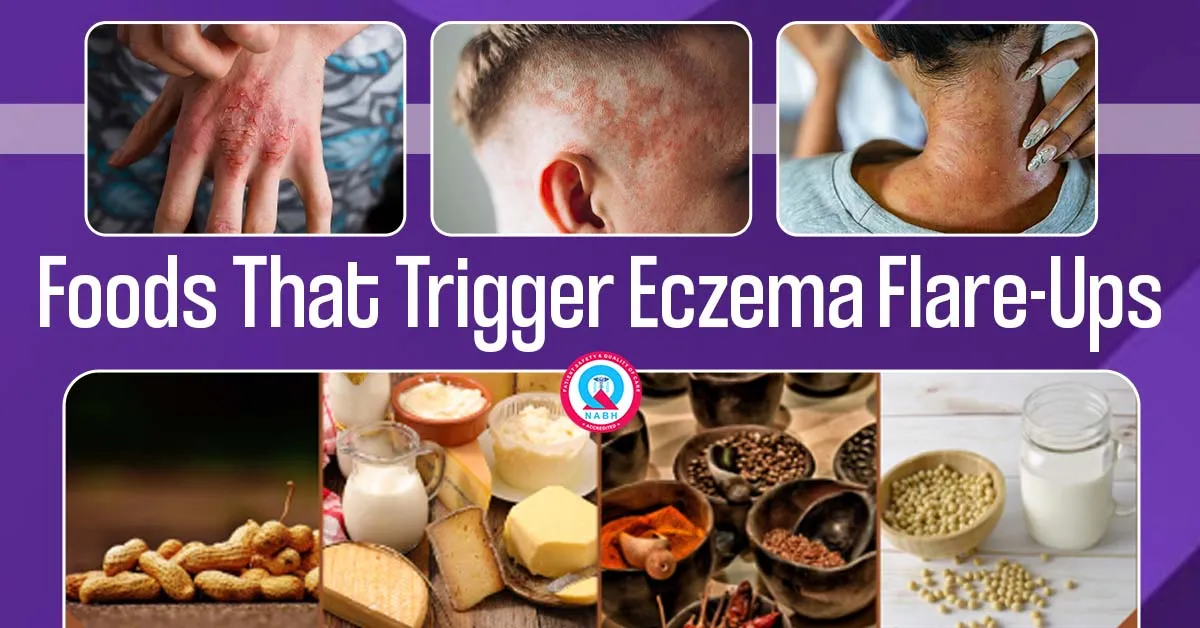 Foods That Trigger Eczema Flare-Ups | Ayurvedic Treatment for Eczema