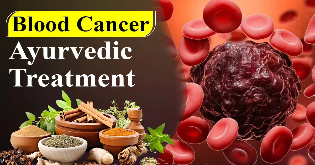 blood-cancer-ayurvedic-treatment