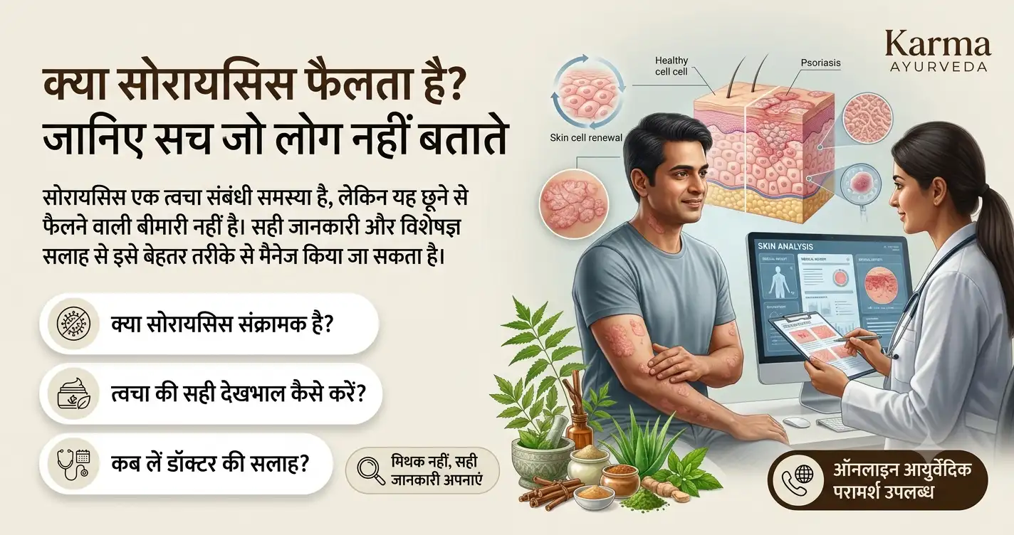 क्या-सोरायसिस-फैलता-है-जानिए-सच-जो-लोग-नहीं-बताते