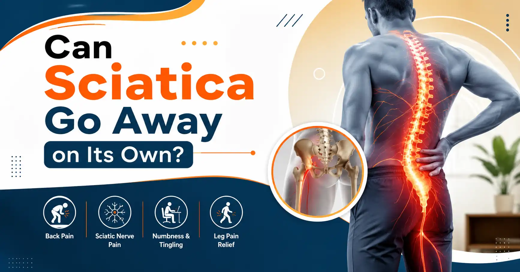 Can Sciatica Go Away on Its Own?