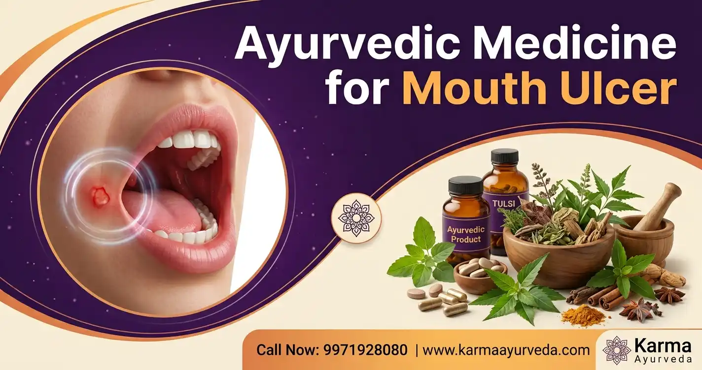ayurvedic-medicine-for-mouth-ulcer