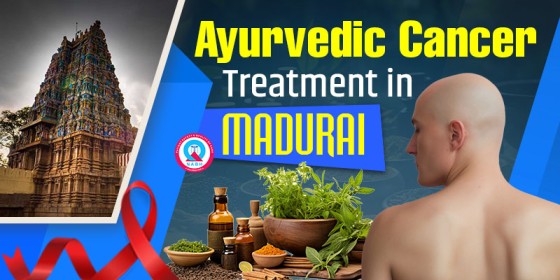 Ayurvedic Cancer Treatment in Madurai